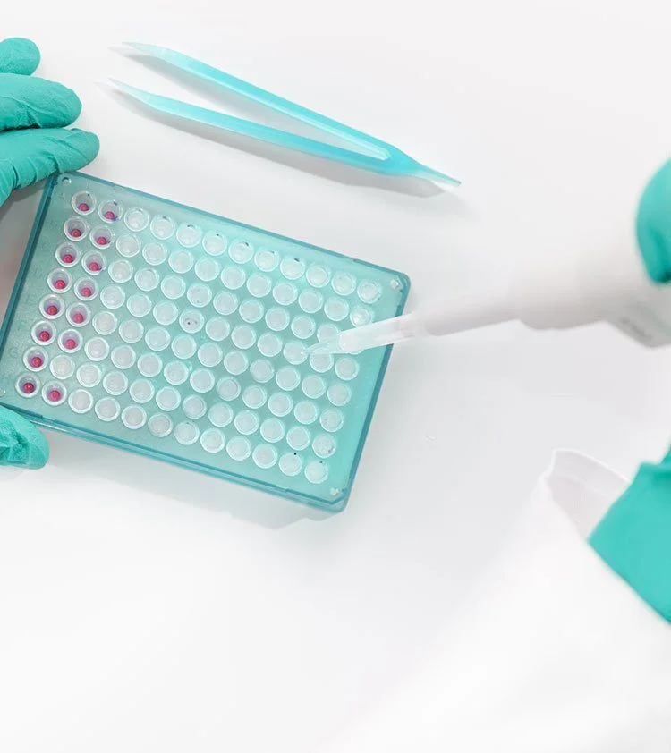 NIPT Testing Blood Sample